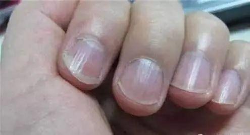 兰陵吃指甲盖的瓜视频,挑战极限的美食冒险 兰陵吃指甲盖的瓜视频,挑战极限的美食冒险